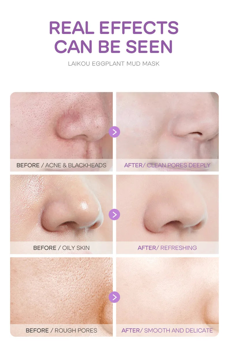 5pcs LAIKOU Eggplant Mud Mask